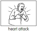 heart attack