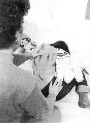 Child covered with bruises