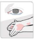 wash hands and eyes